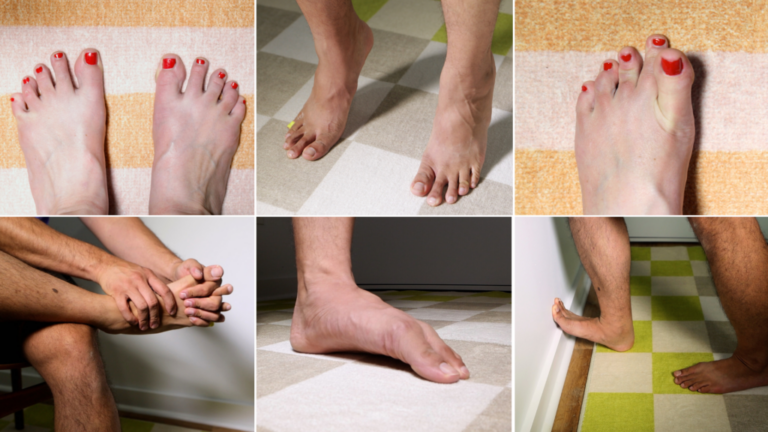 A grid of six, two by three, showing close-ups of six different foot stretches and exercises being demoed by two different people, including: toe spreads, calf raises, toe yoga, holding hands with your feet, foot doming, and wall stretches.