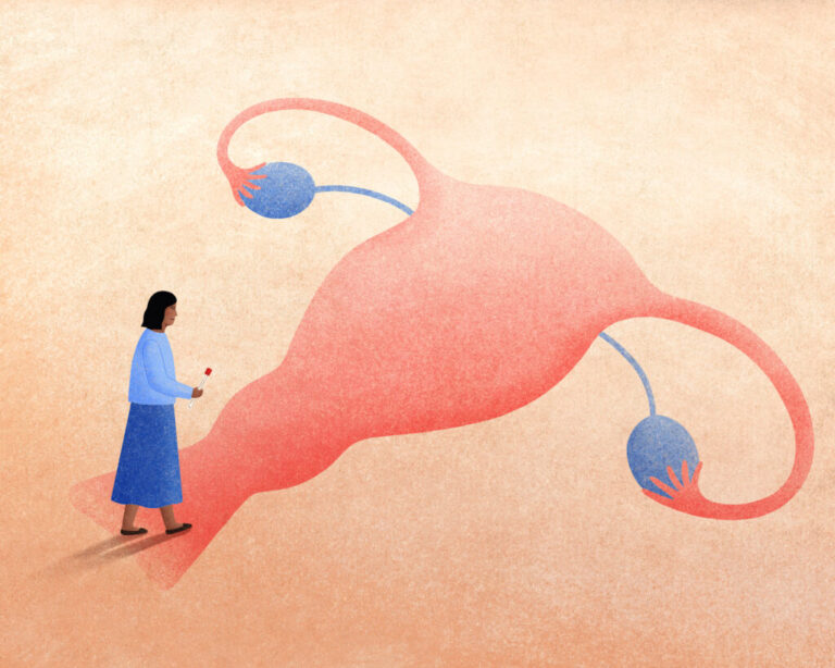 A woman considers her options for cervical cancer screening