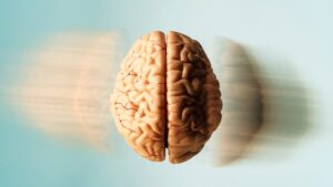 Our favorite brains, including Einstein’s stolen one