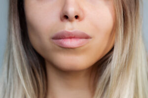 In pursuit of ‘Instagram face,’ are we losing the imperfections that make us human?