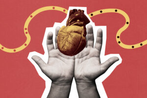 A new proposal for organ donation sparks concern