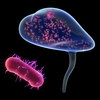 Globally, there are more than 400 million UTIs a year. This illustration depicts the most common kind of UTI—bladder (blue) inflammation caused by E. coli (red).