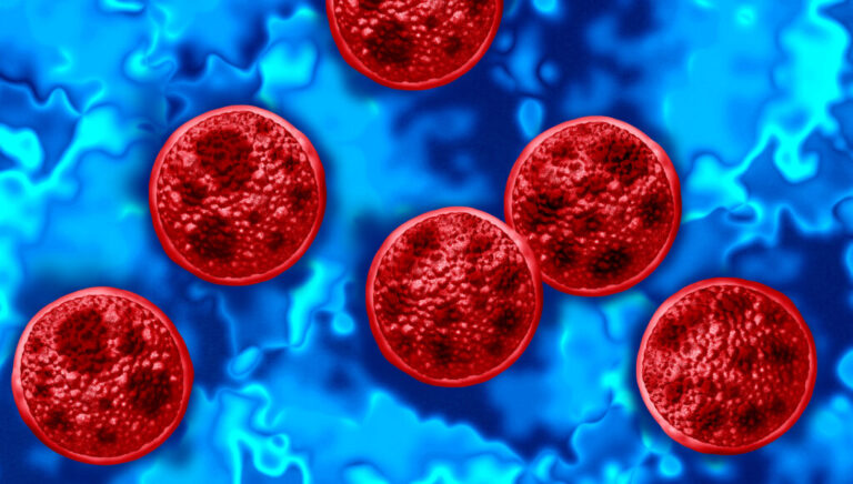 Cyclosporiasis is a foodborne illness caused by contaminated food or water carrying the Cyclospora parasite. FDA officials have yet to figure out the source of the outbreak that the CDC says has sicked more than 1,600 people this summer.