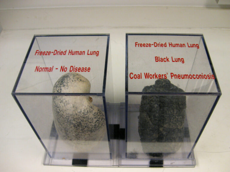 On the left is a preserved healthy human lung displayed in a clear cube. The lung is white with some black dots. On the right in a similar clear display cube is the completely black lung of a coal miner who died from black lung disease.