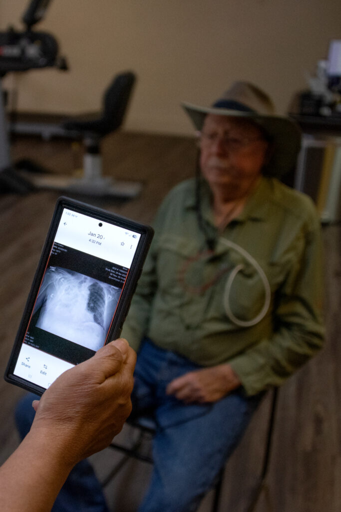 Radiologist Brandon Crum holds a tablet that shows an image of a coal miner's lungs, which are riddled with fibrotic tissue.
