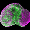Tiny Lab-Grown 'Brains' Raise Big Ethical Questions