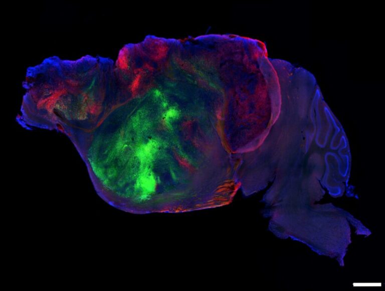 This side view of a lab mouse brain shows nerve fibers extending from the human graft (colored with green and red fluorescent proteins) through the mouse brain (colored with blue). Scale bar = 1 mm.